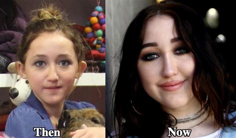 noah cyrus nose job|What These Pop Stars Looked Like Before And After Plastic Surgery